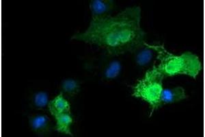 Image no. 7 for anti-Parvin, alpha (PARVA) antibody (ABIN1496442)