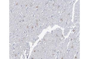 ABIN6266562 at 1/100 staining human brain tissue sections by IHC-P.