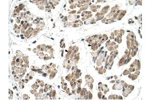 FKTN antibody was used for immunohistochemistry at a concentration of 4-8 ug/ml to stain Skeletal muscle cells (arrows) in Human Muscle.