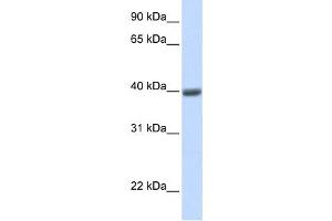 Western Blotting (WB) image for anti-Melanoma Antigen Family A, 1 (Directs Expression of Antigen MZ2-E) (MAGEA1) antibody (ABIN2458988) (MAGEA1 anticorps)