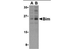 Western Blotting (WB) image for anti-BCL2-Like 11 (Apoptosis Facilitator) (BCL2L11) (Middle Region 2) antibody (ABIN1031197) (BIM anticorps  (Middle Region 2))
