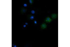 Image no. 2 for anti-NADH Dehydrogenase (Ubiquinone) 1 beta Subcomplex, 10, 22kDa (NDUFB10) antibody (ABIN1499671) (NDUFB10 anticorps)