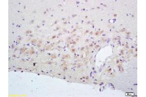 Formalin-fixed and paraffin embedded rat brain labeled with Rabbit Anti NR2A/NMDAR2A Polyclonal Antibody, Unconjugated (ABIN747353) at 1:200 followed by conjugation to the secondary antibody and DAB staining (NMDAR2A anticorps  (AA 851-950))