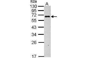 WB Image Sample (30 ug of whole cell lysate) A: BCL-1 12% SDS PAGE antibody diluted at 1:1000 (C4BPB anticorps)