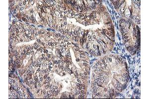 Image no. 10 for anti-F-Box Protein 21 (FBXO21) antibody (ABIN1498232) (FBXO21 anticorps)