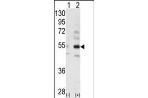 Western blot analysis of ALS2CR2 (arrow) using ALS2CR2 Antibody (C-term ) (ABIN391172 and ABIN2841272). (STRADB anticorps  (C-Term))