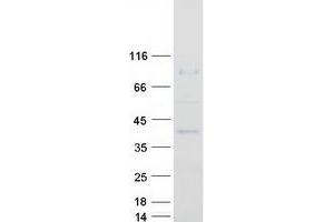 Validation with Western Blot