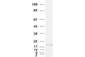 Succinate Dehydrogenase Complex Assembly Factor 2 (Sdhaf2) protein (Myc-DYKDDDDK Tag)