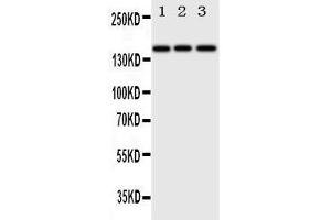 Anti-ErbB 4 antibody, Western blotting Lane 1: HELA Cell Lysate Lane 2: U87 Cell Lysate Lane 3: NEURO Cell Lysate (ERBB4 anticorps  (N-Term))