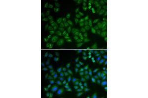 Immunofluorescence analysis of HeLa cells using SMPD1 antibody (ABIN5974079). (SMPD1 anticorps)