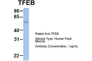 Host: Rabbit  Target Name: TFEB  Sample Tissue: Human Fetal Muscle  Antibody Dilution: 1. (TFEB anticorps  (Middle Region))