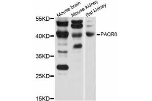 Western blot analysis of extracts of various cell lines, using PAQR8 antibody (ABIN6293387) at 1:1000 dilution. (PAQR8 anticorps)