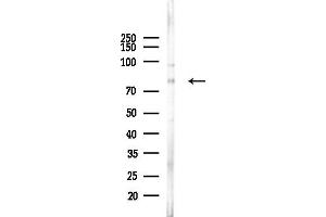 anti-Protein Kinase C, delta (PKCd) (C-Term) antibody