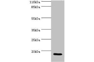 Western blot All lanes: JPT1 antibody at 2 μg/mL + Rat gonad tissue Secondary Goat polyclonal to rabbit IgG at 1/10000 dilution Predicted band size: 17, 20, 12 kDa Observed band size: 17 kDa (JPT1 anticorps  (AA 2-154))