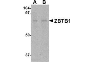 Western blot analysis of ZBTB1 in HepG2 lysate with this product at (A) 1 and (B) 2 μg/ml.