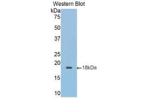 Western Blotting (WB) image for anti-Hexokinase 1 (HK1) (AA 413-540) antibody (ABIN1859174)