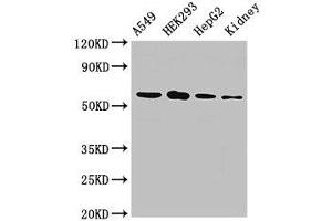 WB analysis of A549 whole cell lysates, HEK293 whole cell lysates, HepG2 whole cell lysates, and Rat Kidney tissue, using P4HA1 antibody (2. (P4HA1 anticorps  (AA 256-525))