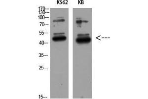 Western Blot (WB) analysis of K562 KB using GDF-3 Polyclonal Antibody diluted at 1:500.