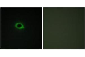 Immunofluorescence analysis of COS7 cells, using TENS3 Antibody.