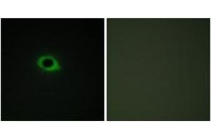 Immunofluorescence analysis of COS7 cells, using TENS3 Antibody. (TNS3 anticorps  (AA 541-590))