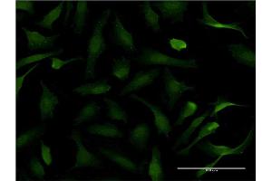 Immunofluorescence of monoclonal antibody to PER2 on HeLa cell. (PER2 anticorps  (AA 1-100))
