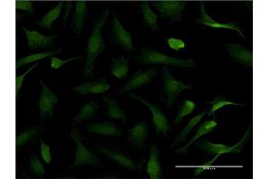 Immunofluorescence of monoclonal antibody to PER2 on HeLa cell. (PER2 anticorps  (AA 1-100))