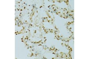 Immunohistochemistry of paraffin-embedded rat lung using RCC1 antibody (ABIN5973761) at dilution of 1/100 (40x lens). (RCC1 anticorps)