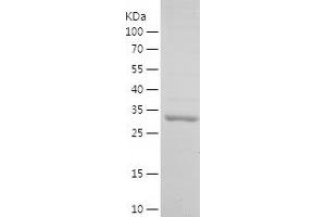 Western Blotting (WB) image for Small Proline-Rich Protein 3 (SPRR3) (AA 99-169) protein (His-IF2DI Tag) (ABIN7125141) (SPRR3 Protein (AA 99-169) (His-IF2DI Tag))