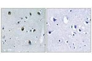 Immunohistochemistry analysis of paraffin-embedded human skeletal muscle tissue using Collagen XX α1 antibody.