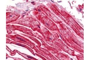 Immunohistochemistry of ILPIP in human heart tissue with ILPIP antibody at 5 μg/ml.