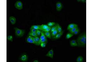 Immunofluorescence staining of HepG2 cells with ABIN7145017 at 1:133, counter-stained with DAPI. (KCNJ1 anticorps  (AA 165-379))