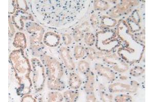 IHC-P analysis of Human Kidney Tissue, with DAB staining. (HMGB1 anticorps  (AA 1-215))