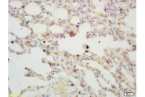 Formalin-fixed and paraffin embedded mouse lung labeled with Rabbit Anti TIGAR Polyclonal Antibody, Unconjugated (ABIN671286) at 1:200 followed by conjugation to the secondary antibody and DAB staining