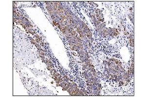 IHC analysis of DLGAP1 using anti-DLGAP1 antibody (ABIN7600257). (DLGAP1 anticorps  (AA 17-319))