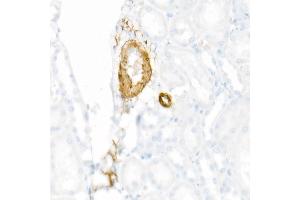 Immunohistochemistry of paraffin-embedded Rat kidney using using SMMHC/MYH11 antibody (ABIN7268745) at dilution of 1:8100 (40x lens). (MYH11 anticorps)