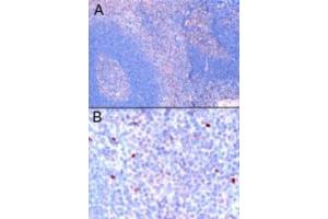 Immunohistochemistry (IHC) image for anti-Forkhead Box P3 (FOXP3) (C-Term) antibody (ABIN2465214) (FOXP3 anticorps  (C-Term))