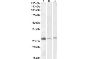 ABIN768557 (1 μg/mL) staining of Human Liver (A), Kidney (B) and -Mouse Liver (C) lysate (35 μg protein in RIPA buffer).