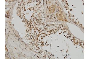 Immunoperoxidase of monoclonal antibody to ACTN4 on formalin-fixed paraffin-embedded human testis.