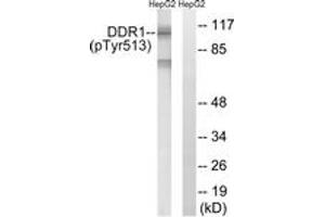 Western blot analysis of extracts from HepG2 cells treated with Na3VO4 0. (DDR1 anticorps  (pTyr513))