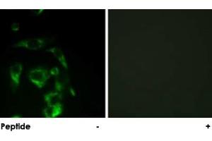 Immunofluorescence analysis of HeLa cells, using EIF4G1 polyclonal antibody . (EIF4G1 anticorps)