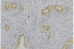 ABIN6276769 at 1/100 staining Human uterus tissue by IHC-P. (Prolactin anticorps  (Internal Region))