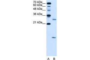 Western Blotting (WB) image for anti-Vacuolar H+-ATPase Homolog (VMA21) antibody (ABIN2463979) (VMA21 anticorps)