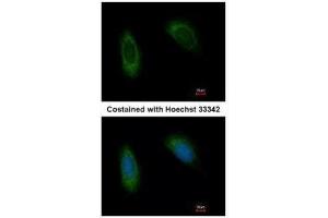ICC/IF Image Immunofluorescence analysis of methanol-fixed HeLa, using TRAM1, antibody at 1:500 dilution.