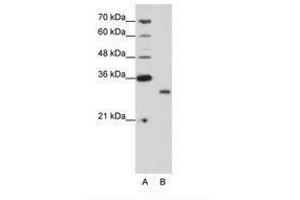 Image no. 1 for anti-CPX Chromosome Region, Candidate 1 (CPXCR1) (N-Term) antibody (ABIN202196) (CPXCR1 anticorps  (N-Term))