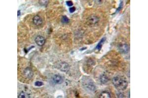 Used in DAB staining on fromalin fixed paraffin-embedded Liver tissue (Afamin anticorps  (AA 211-403))