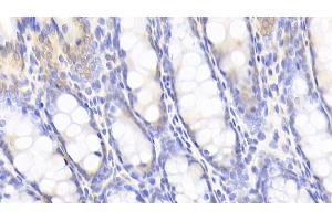 Detection of CYPA in Rat Colon Tissue using Polyclonal Antibody to Cyclophilin A (CYPA)