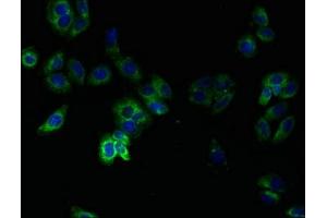 anti-Transmembrane Protein 14B (TMEM14B) (AA 1-114) antibody