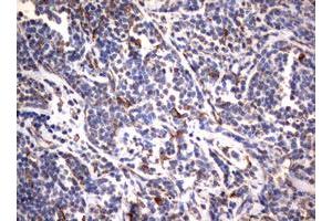 Image no. 4 for anti-Vimentin (VIM) (AA 210-466) antibody (ABIN1491200)