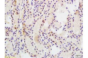 Formalin-fixed and paraffin embedded rat kidney tissue labeled Anti-MRP1 Polyclonal Antibody, Unconjugated  at 1:200, followed by conjugation to the secondary antibody and DAB staining (Multidrug-Resistance Like Protein 1 anticorps  (AA 501-600))