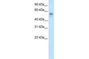 Western Blotting (WB) image for anti-BTB (POZ) Domain Containing 3 (BTBD3) antibody (ABIN2461861) (BTBD3 anticorps)